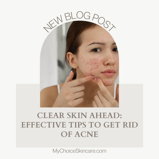 Discover the ultimate guide to combat acne and achieve clear, glowing skin! Uncover effective strategies, skincare tips, and lifestyle changes to get rid of acne for good. Say goodbye to breakouts and hello to confidence! 🌟💫